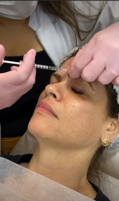 dra_angie_aplicando_botox_na_clinica_espaco_corpo