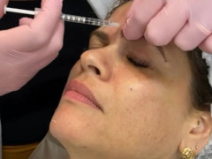 dra_angie_aplicando_botox_na_clinica_espaco_corpo
