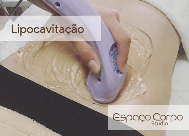 Foto de aplicação da lipocavitação do Espaço Corpo na região do abdomen inferior.